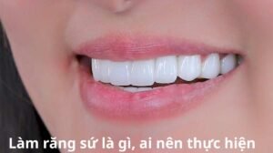 bọc răng sứ là gì, ai nên thực hiện