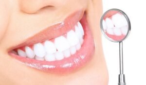 Lợi Ích Của Bọc Răng: Tại Sao Nên Chọn Giải Pháp Thẩm Mỹ Này?